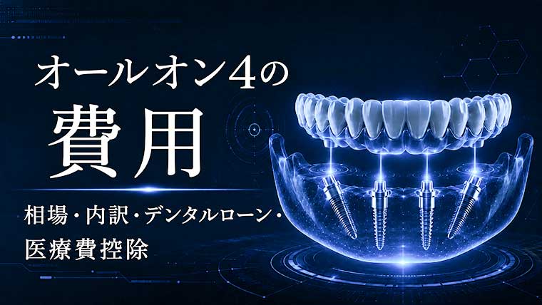 オールオン4の費用― 相場・内訳・デンタルローン・医療費控除