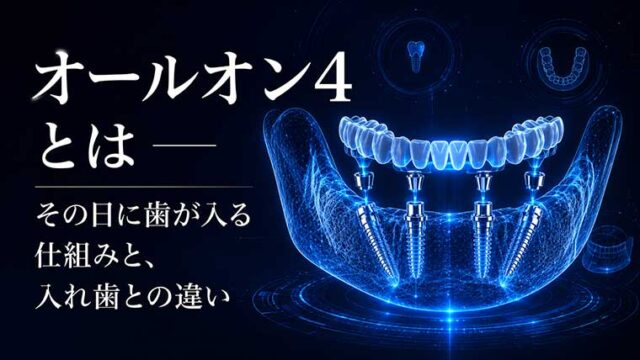 オールオン4とは ― その日に歯が入る仕組みと、入れ歯との違い