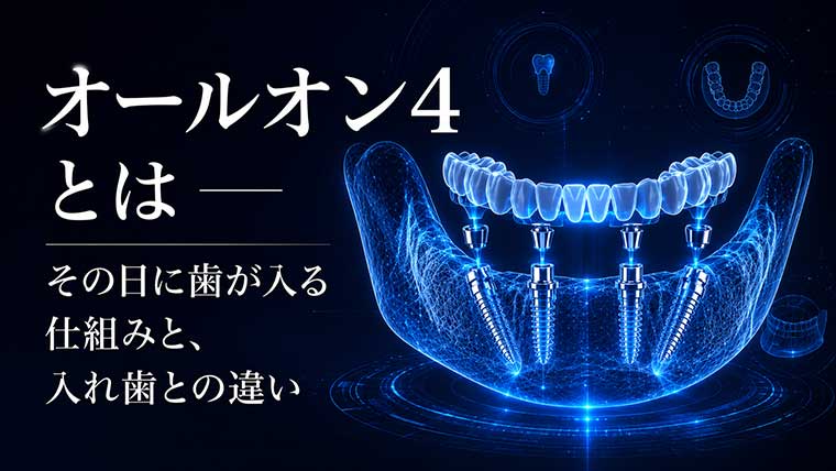オールオン4とは ― その日に歯が入る仕組みと、入れ歯との違い