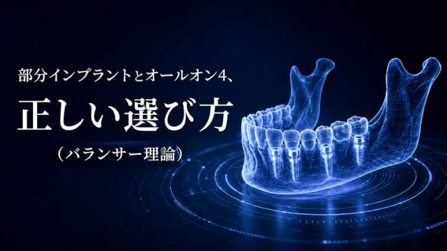 部分インプラントとオールオン4、 正しい選び方（バランサー理論）
