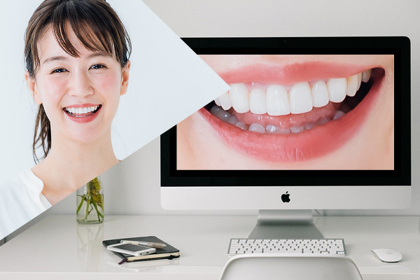 無料オンラインカウンセリング