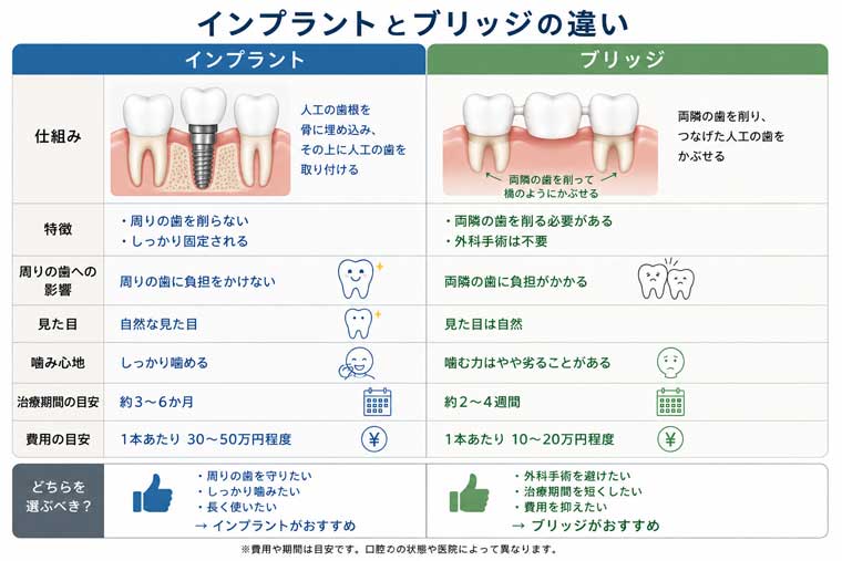 インプラントとブリッジの構造はどう違うの？の図解