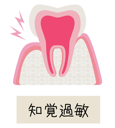 知覚過敏