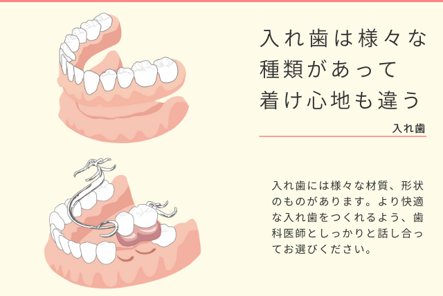 入れ歯は様々な種類があって着け心地も違う