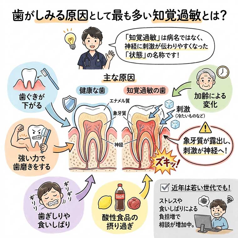 歯がしみる原因として最も多い知覚過敏とは？の図解