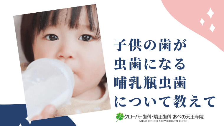 子供の歯が虫歯になる哺乳瓶虫歯について教えて