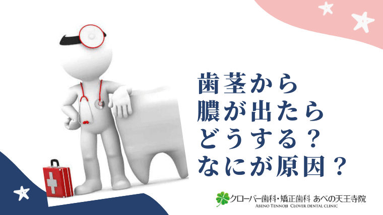 歯茎から膿が出たらどうする？なにが原因？