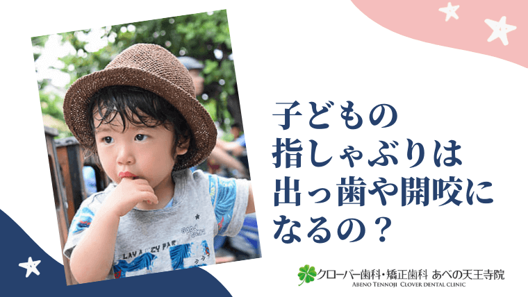 子どもの指しゃぶりは出っ歯や開咬になるの？