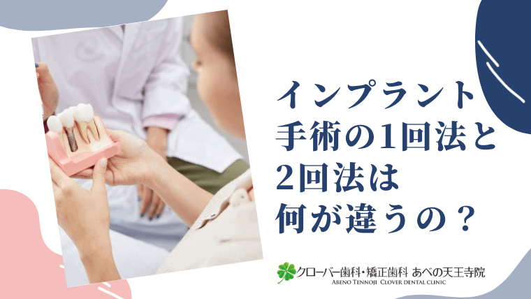 インプラント手術の1回法と2回法は何が違うの？