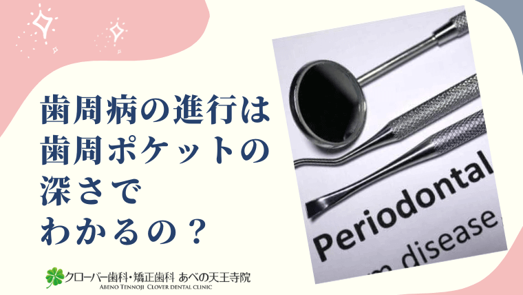 歯周病の進行は歯周ポケットの深さでわかるの？