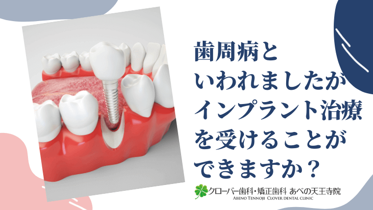 歯周病といわれましたがインプラント治療を受けることができますか？
