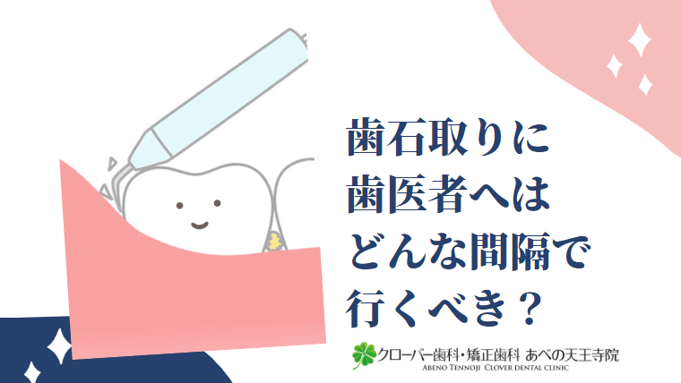 歯石取りに歯医者へはどんな間隔で行くべき？