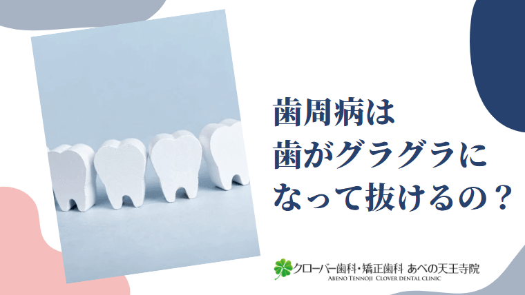 歯周病は歯がグラグラになって抜けるの？