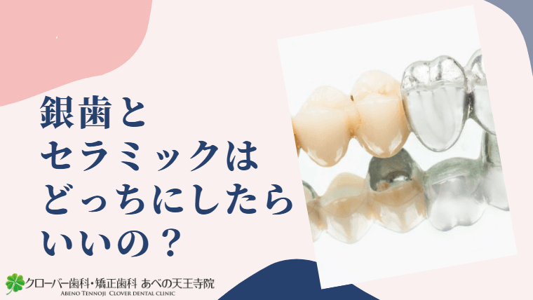 銀歯とセラミックはどっちにしたらいいの？