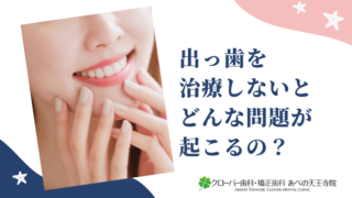不正咬合の種類について教えて｜よくあるご質問 クローバー歯科