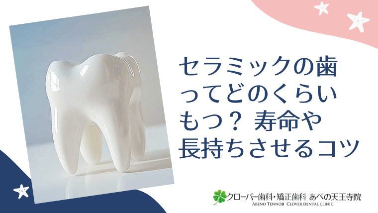 セラミックの歯ってどのくらいもつ?