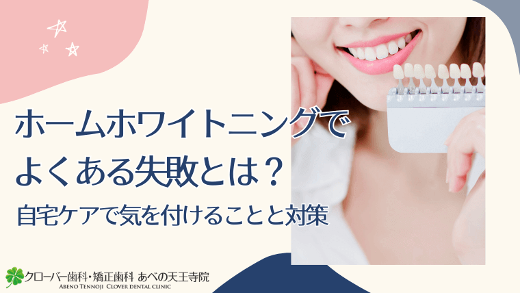 ホームホワイトニングでよくある失敗とは?