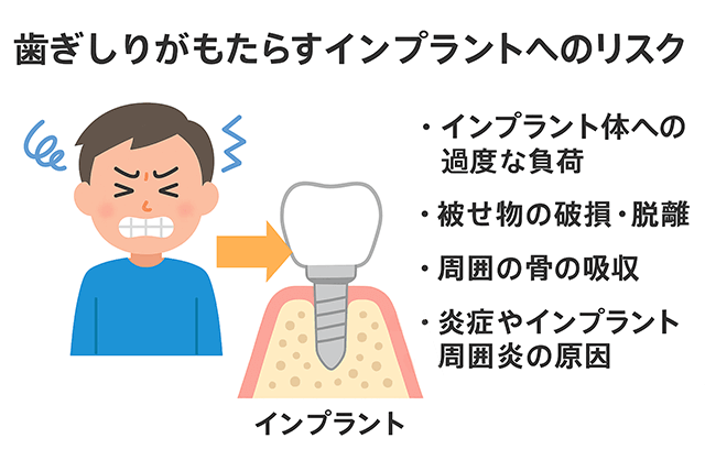 歯ぎしりのリスク
