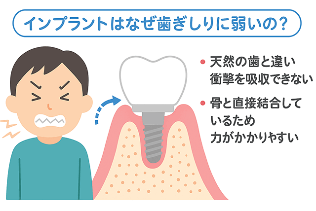 歯ぎしりに弱い理由