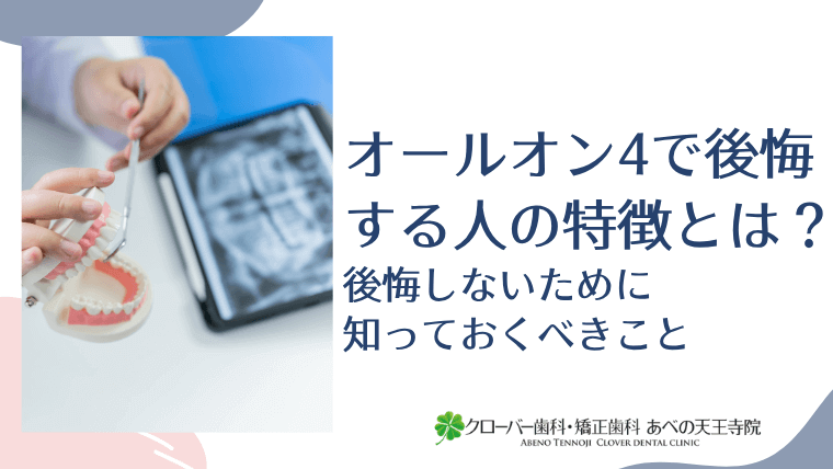 オールオン4で後悔する人の特徴とは?