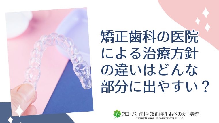 矯正歯科の医院による治療方針の違いはどんな部分に出やすい?