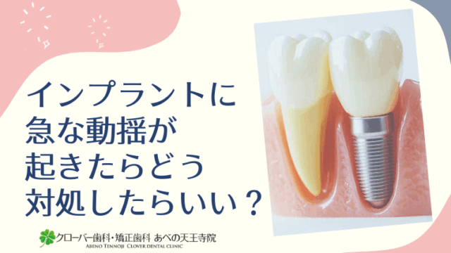 インプラントに急な動揺が起きたらどう対処したらいい？