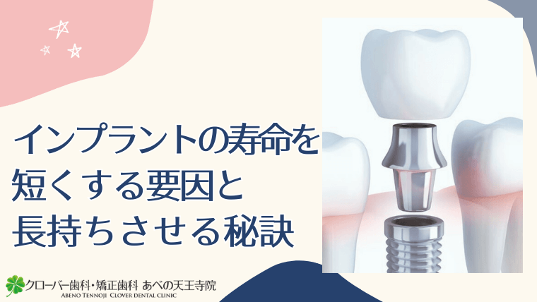 インプラントの寿命を短くする要因と長持ちさせる秘訣