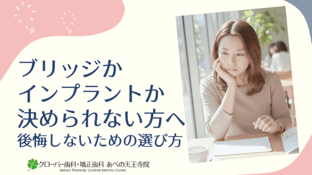 ブリッジかインプラントか決められない方へ