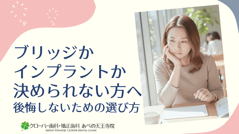 ブリッジかインプラントか決められない方へ 