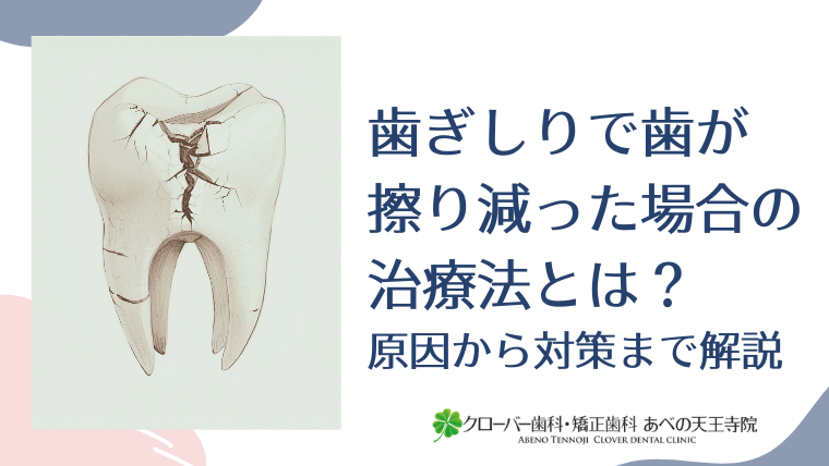 歯ぎしりで歯が擦り減った場合の治療法とは？