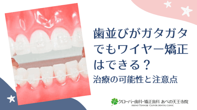 歯並びがガタガタでもワイヤー矯正はできる？