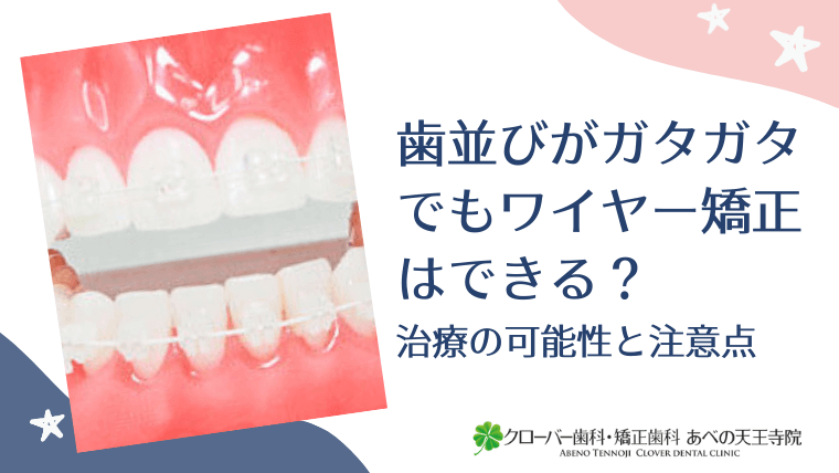 歯並びがガタガタでもワイヤー矯正はできる？