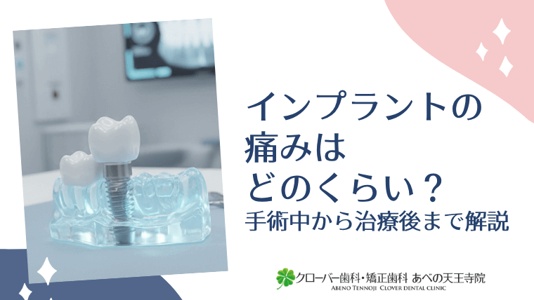 インプラントの痛みはどのくらい？