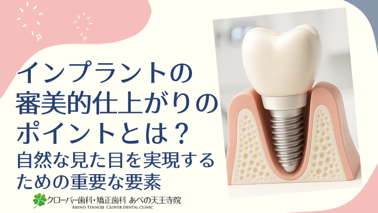インプラントの審美的仕上がりのポイントとは?