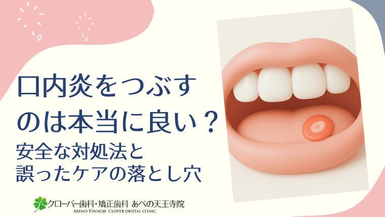 口内炎をつぶすのは本当に良い？