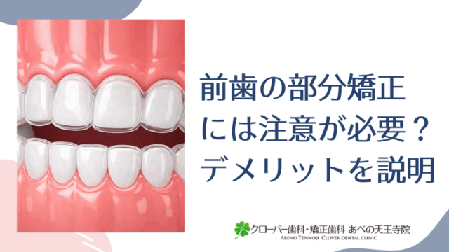 前歯の部分矯正には注意が必要？デメリットを説明