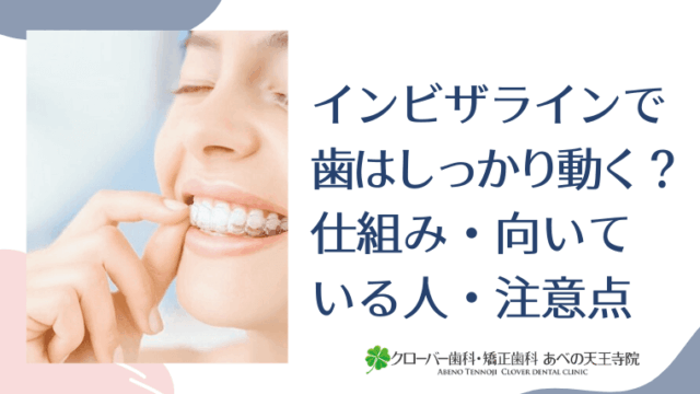 インビザラインで歯はしっかり動く？