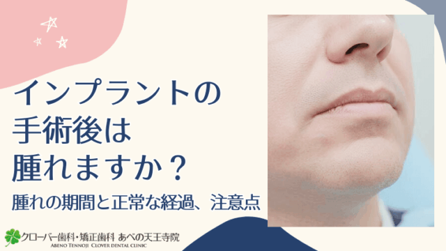 インプラント手術後は腫れますか？腫れの期間と正常な経過、注意点