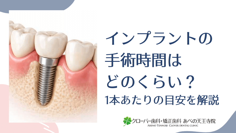 インプラントの手術時間はどのくらい？1本あたりの目安を解説
