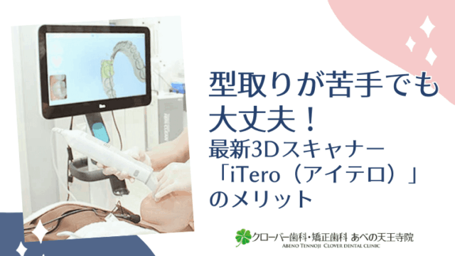 型取りが苦手でも大丈夫！最新3Dスキャナー「iTero（アイテロ）」のメリット