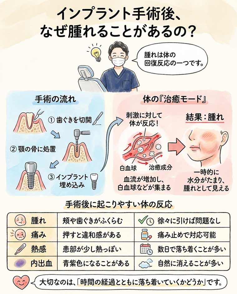 インプラント手術後、なぜ腫れることがあるの？の図解
