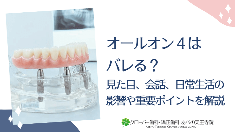 オールオン4はバレる？見た目、会話、日常生活の影響や重要ポイントを徹底解説