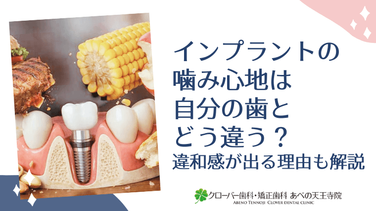 インプラントの噛み心地は自分の歯とどう違う？違和感が出る理由も解説