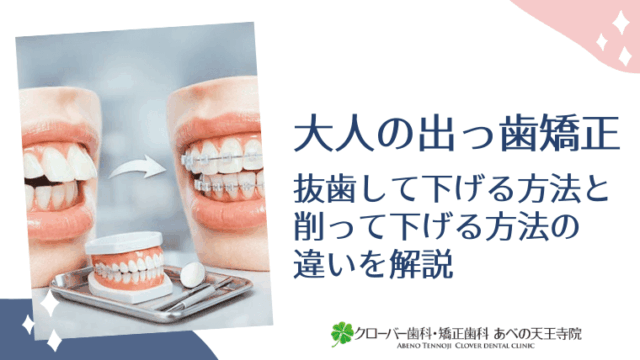 大人の出っ歯矯正｜抜歯して下げる方法と削って下げる方法の違いを解説