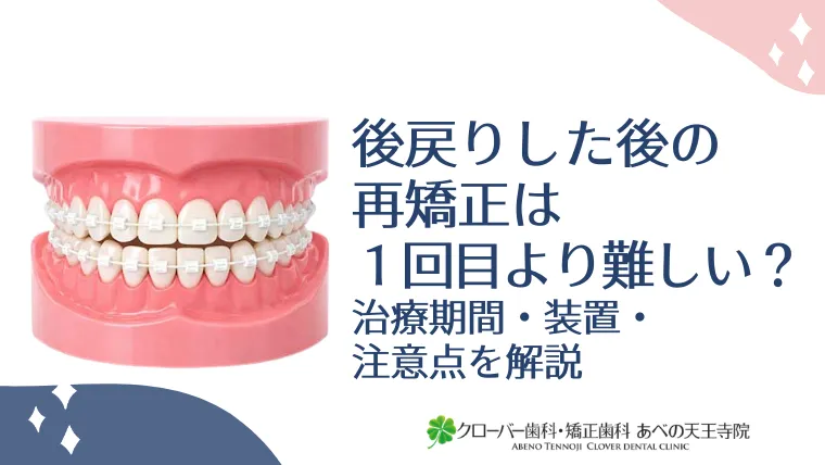 後戻りした後の再矯正は1回目より難しい？治療期間・装置・注意点をわかりやすく解説