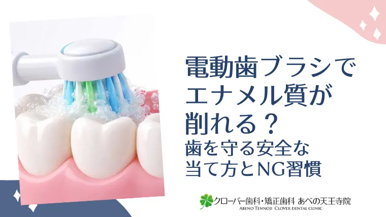 電動歯ブラシでエナメル質が削れる？歯を守る安全な当て方とNG習慣