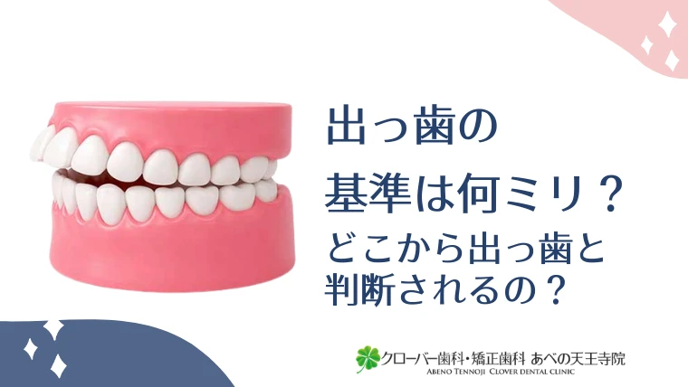 出っ歯の基準は何ミリ？どこから出っ歯と判断されるの？