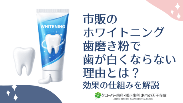 市販のホワイトニング歯磨き粉で歯が白くならない理由とは？効果の仕組みを解説