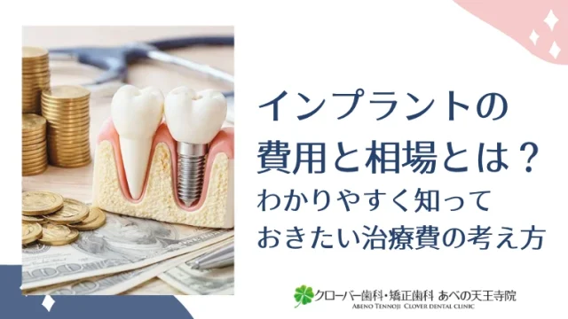 インプラントの費用と相場とは？わかりやすく知っておきたい治療費の考え方
