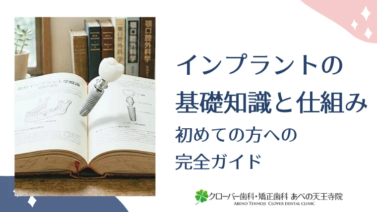 インプラントの基礎知識と仕組み：初めての方への完全ガイド
